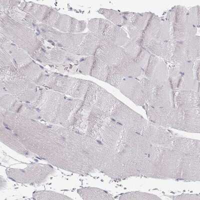 Immunohistochemistry-Paraffin: S100B Antibody [NBP1-87102]
