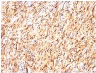 Immunohistochemistry-Paraffin: S100B Antibody (S100B/1012) - Azide and BSA Free [NBP2-59619]