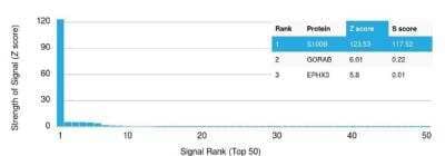 Protein Array: S100B Antibody (S100B/1012) [NBP2-59618]