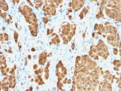 Immunohistochemistry-Paraffin: S100B Antibody (S100B/1706R) - Azide and BSA Free [NBP2-54426]