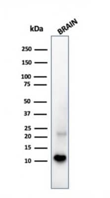 Western Blot: S100B Antibody (S100B/1706R)Azide and BSA Free [NBP2-54426]