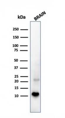 Western Blot: S100B Antibody (S100B/1706R) [NBP2-53188]