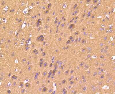 Immunohistochemistry-Paraffin: S100B Antibody (SC57-02) [NBP2-67572]