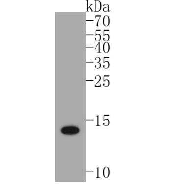 Western Blot: S100B Antibody (SC57-02) [NBP2-67572]
