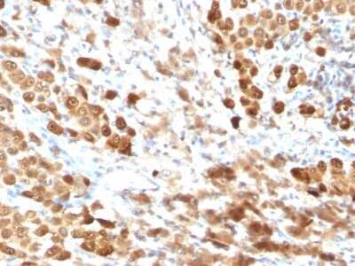Immunohistochemistry-Paraffin: S100B Antibody (SPM354) - Azide and BSA Free [NBP2-54399]