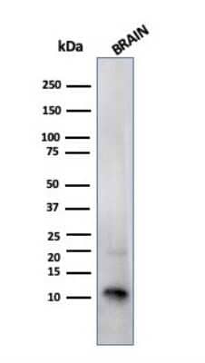 Western Blot: S100B Antibody (SPM354)Azide and BSA Free [NBP2-54399]