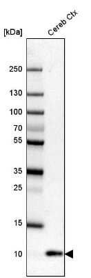 Western Blot: S100B Antibody [NBP1-87102]