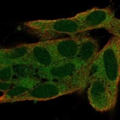 Immunocytochemistry/ Immunofluorescence: S100G Antibody [NBP3-17618]