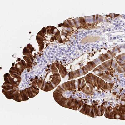 Immunohistochemistry: S100G Antibody [NBP2-31615]