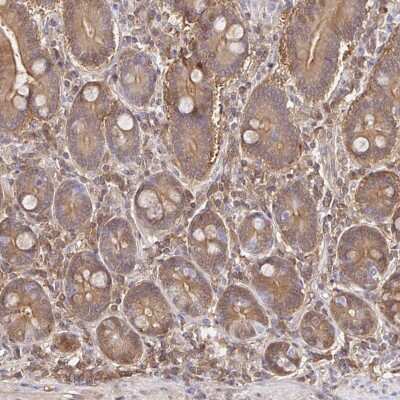 Immunohistochemistry-Paraffin: S100G Antibody [NBP2-31615]