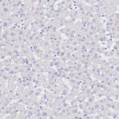 Immunohistochemistry-Paraffin: S100G Antibody [NBP2-31615]