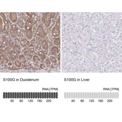 Immunohistochemistry-Paraffin: S100G Antibody [NBP2-31615]
