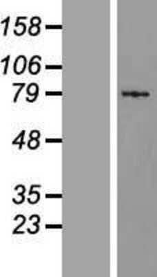 Western Blot: S100G Overexpression Lysate [NBL1-15662]