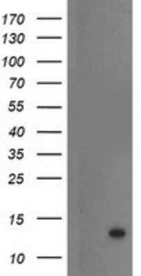 Western Blot: S100P Antibody (OTI1A4) [NBP2-01900]