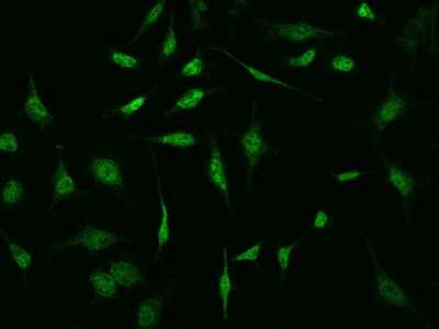 Immunocytochemistry/ Immunofluorescence: S100P Antibody [NBP2-99514]