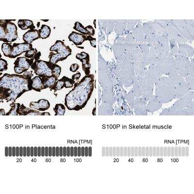 Immunohistochemistry-Paraffin: S100P Antibody [NBP1-89541]