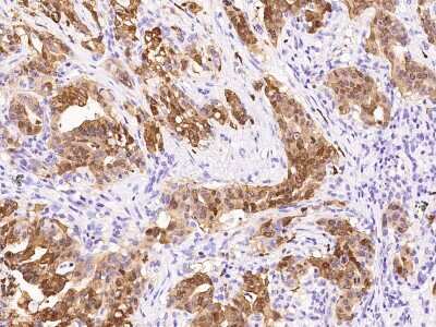 Immunohistochemistry-Paraffin: S100P Antibody [NBP2-99514]