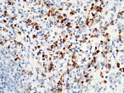 Immunohistochemistry-Paraffin: S100P Antibody [NBP3-00029]