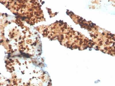 Immunohistochemistry-Paraffin: S100P Antibody (S100P/4386R) [NBP3-07746]