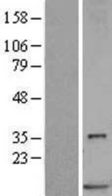 Western Blot: S100P Overexpression Lysate [NBL1-15663]