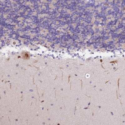 Immunohistochemistry-Paraffin: S100P binding protein Antibody [NBP2-48580]