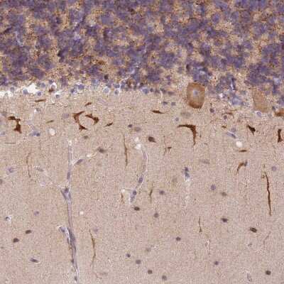 Immunohistochemistry-Paraffin: S100P binding protein Antibody [NBP2-48581]