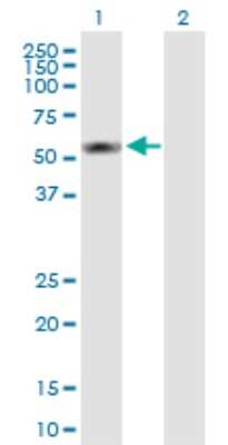 Western Blot: S100P binding protein Antibody [H00064766-B01P]