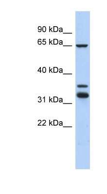 Western Blot: S100P binding protein Antibody [NBP1-56954]