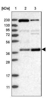 Western Blot: S100P binding protein Antibody [NBP2-48580]