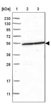 Western Blot: S100P binding protein Antibody [NBP2-48581]