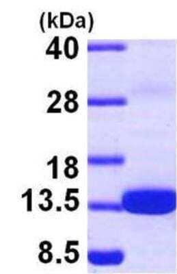 Western Blot: Recombinant Human S100Z His Protein [NBP1-45254]