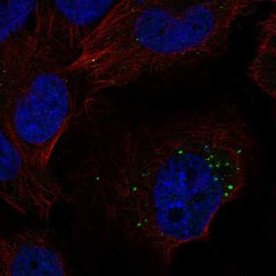 Immunocytochemistry/ Immunofluorescence: S1P1/EDG-1 Antibody [NBP2-58024]