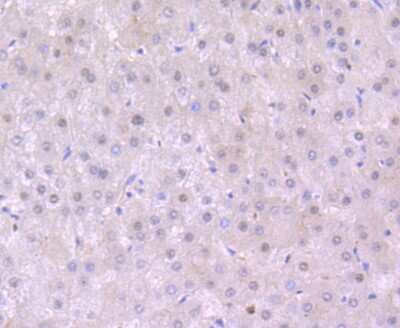 Immunohistochemistry-Paraffin: S1P1/EDG-1 Antibody (JM10-66) [NBP2-67129]