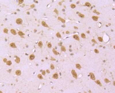 Immunohistochemistry-Paraffin: S1P1/EDG-1 Antibody (JM10-66) [NBP2-67129]