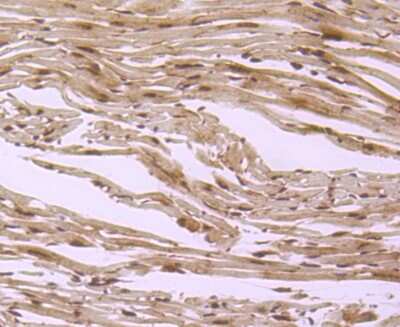 Immunohistochemistry-Paraffin: S1P1/EDG-1 Antibody (JM10-66) [NBP2-67129]
