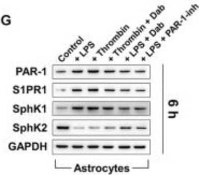 Western Blot: S1P1/EDG-1 Antibody [NB120-11424]