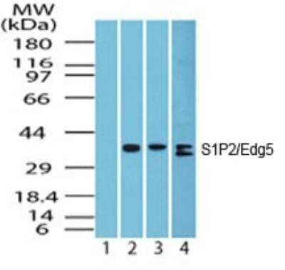 Western Blot: S1P2/EDG-5/S1PR2 Antibody [NBP2-26691]