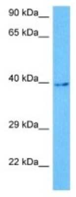 Western Blot: S1P2/EDG-5/S1PR2 Antibody [NBP3-10068]