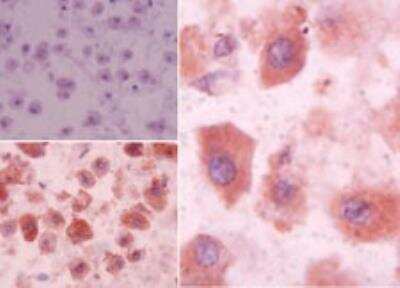 Immunohistochemistry-Paraffin: S1P3/EDG-3 Antibody [NBP2-24762]