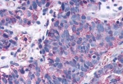 Immunohistochemistry-Paraffin: S1P3/EDG-3 Antibody [NBP3-14467]