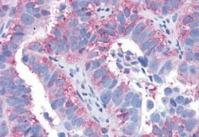 Immunohistochemistry-Paraffin: S1P3/EDG-3 Antibody [NBP3-14467]