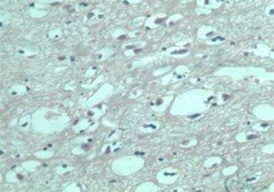 Immunohistochemistry-Paraffin: S1P5/EDG-8 Antibody [NBP2-24712]