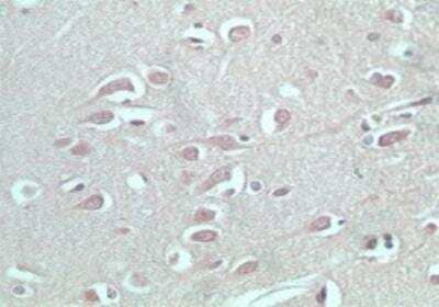 Immunohistochemistry-Paraffin: S1P5/EDG-8 Antibody [NBP2-24712]