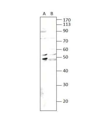 Western Blot: S1P5/EDG-8 Antibody [NBP3-12308]