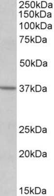 Western Blot: S1P2/EDG-5/S1PR2 Antibody [NBP1-68854]