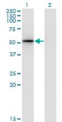 Western Blot: S5a/Angiocidin Antibody (3C9) [H00005710-M01]