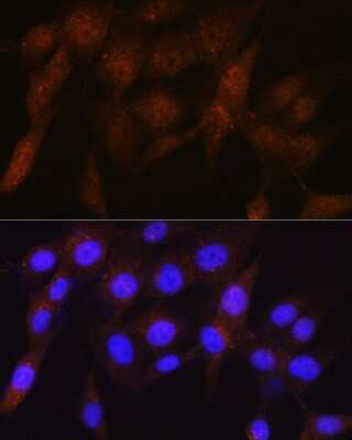 Immunocytochemistry/ Immunofluorescence: S5a/Angiocidin Antibody (5G1X6) [NBP3-16240]