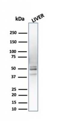 Western Blot: S5a/Angiocidin Antibody (CPTC-PSMD4-3) [NBP3-07250]