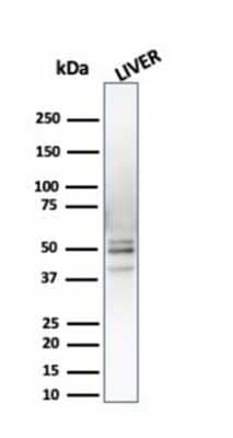 Western Blot: S5a/Angiocidin Antibody (CPTC-PSMD4-3)Azide and BSA Free [NBP3-08271]