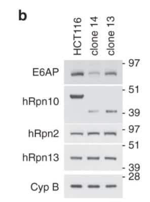 Western Blot: S5a/Angiocidin Antibody [NBP2-19952]